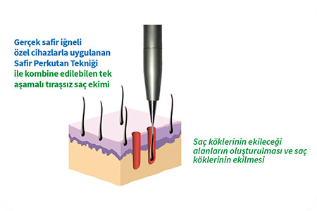 Tıraşsız Saç Ekimi